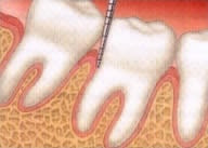 Vereinfachte Darstellung von gesundem Zahnfleisch